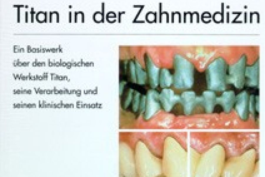 TITAN in der Zahnmedizin( Wirz/ Bischoff) - Bild 1