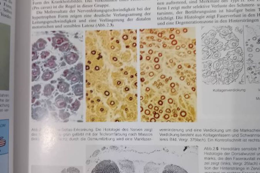 Farbatlas der klinischen Neurologie - Bild 3